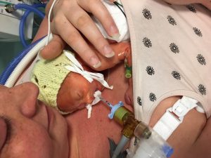 skin-to-skin contact with premature baby and mum in hospital